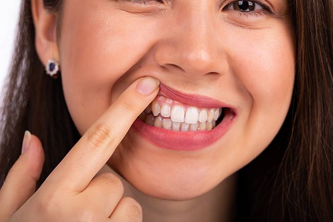 Common Causes Of Sore Gums solution at  in Manhattan Beach, CA 
